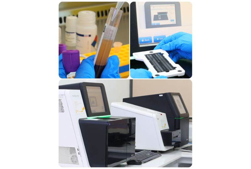 Hi-tech genomic test aims to offer better diagnosis and patient care